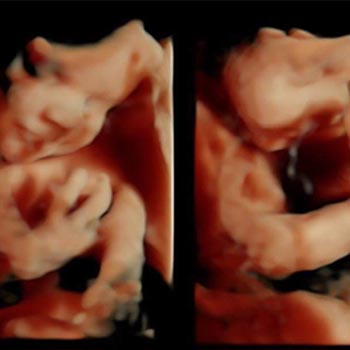in Manchester and Lancashire Into the Blue Little Monkey 4D Baby Scan Gift Experience Voucher